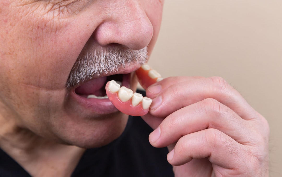 Photo Dental implant